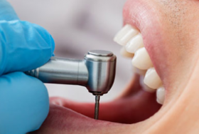 Restorative Dentistry malta, dentist malta, dentistry malta, dental clinic malta, regional dental clinic malta