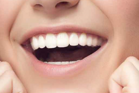 Gum Contouring & Teeth Reshaping malta, Gum Contouring &  Teeth Reshaping malta, dentist malta, dentistry malta, dental clinic malta, regional dental clinic malta