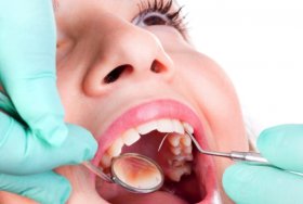  Preventive Dental Treatment malta, dentist malta, dentistry malta, dental clinic malta, regional dental clinic malta